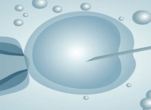 ICSI Intracytoplasmic Sperm Injection
